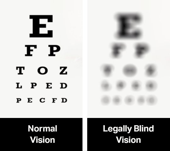 legally-blind-prescription