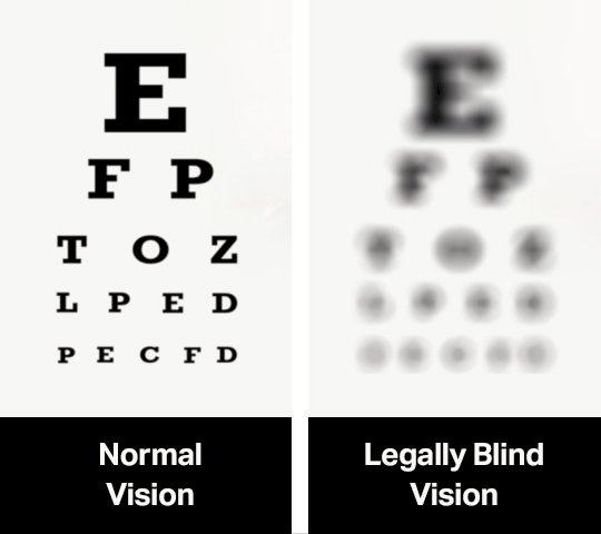 Understand your Eyeglass Prescription | Framesbuy